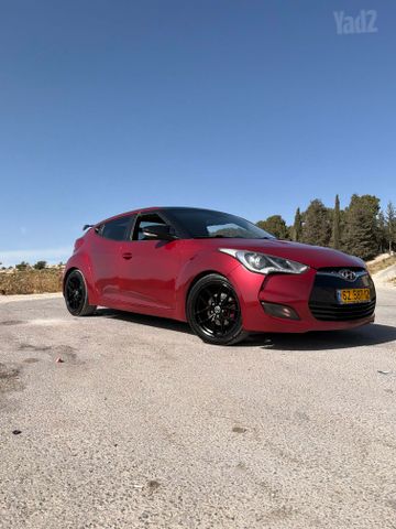 יונדאי ולוסטר