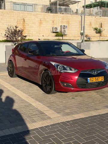 יונדאי ולוסטר