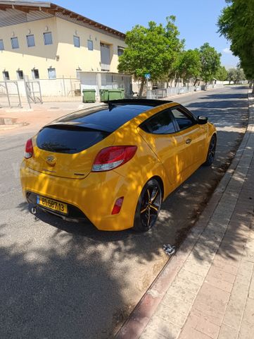 יונדאי ולוסטר